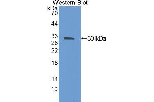 Western blot analysis of the recombinant protein. (ANGPTL4 anticorps  (AA 182-394))