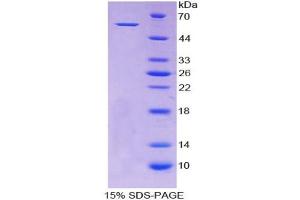 SDS-PAGE analysis of Human ALDH7A1 Protein. (ALDH7A1 Protéine)