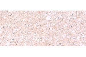 Immunohistochemistry of paraffin-embedded Human brain tissue using RABEPK Polyclonal Antibody at dilution of 1:85(x200) (RABEPK anticorps)