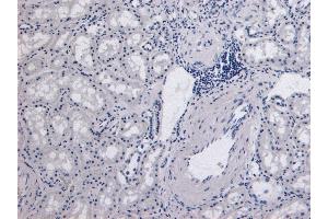 (ABIN185651) Negative Control showing staining of paraffin embedded Human Kidney, with no primary antibody. (Catalase anticorps  (Internal Region))