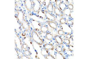 Immunohistochemistry of paraffin-embedded mouse kidney using RNF149 antibody (ABIN7270062) at dilution of 1:100 (40x lens). (RNF149 anticorps  (AA 221-400))