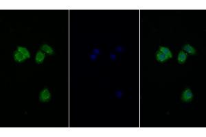 Detection of EIF2aK3 in Human Hela cell using Polyclonal Antibody to Eukaryotic Translation Initiation Factor 2 Alpha Kinase 3 (EIF2aK3)