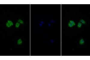 Detection of EIF2aK3 in Human Hela cell using Polyclonal Antibody to Eukaryotic Translation Initiation Factor 2 Alpha Kinase 3 (EIF2aK3) (PERK anticorps  (AA 973-1114))