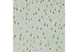 Immunohistochemistry of paraffin-embedded rat brain using RCC1 antibody. (RCC1 anticorps  (AA 1-240))