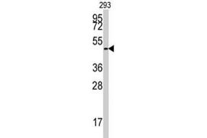 Western blot analysis of E2F1 polyclonal antibody  in 293 cell line lysates (35 ug/lane). (E2F1 anticorps  (Ser332))