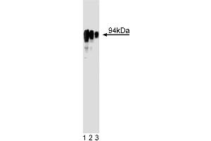 Western blot analysis of glucocorticoid receptor on HeLa cell lysate (right). (Glucocorticoid Receptor anticorps  (AA 176-289))