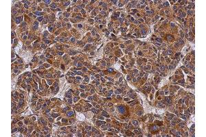 Image no. 1 for anti-Coiled-Coil Domain Containing 50 (CCDC50) (AA 1-187) antibody (ABIN1497124) (CCDC50 anticorps  (AA 1-187))