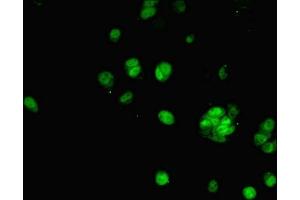 Immunofluorescent analysis of MCF-7 cells using ABIN7143011 at dilution of 1:100 and Alexa Fluor 488-congugated AffiniPure Goat Anti-Rabbit IgG(H+L)