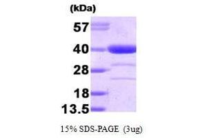 Figure annotation denotes ug of protein loaded and % gel used. (Alcohol Dehydrogenase (ADH) (AA 1-325) Protéine)