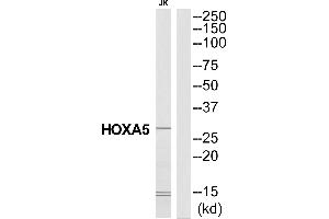 Western blot analysis of extracts from Jurkat cells, using HXA5 antibody. (HOXA5 anticorps  (N-Term))