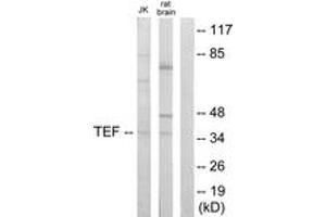 Western Blotting (WB) image for anti-Thyrotrophic Embryonic Factor (TEF) (AA 211-260) antibody (ABIN2889561) (TEF anticorps  (AA 211-260))