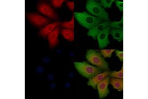 ABIN6262052 and ABIN6268767 staining Hela cells by IF/ICC. (O3FAR1 anticorps  (Internal Region))