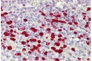 IHC Suggested Anti-ZNF746 antibody  Titration: 5ug/ ml Positive Control: Spleen