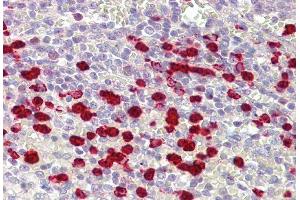 IHC Suggested Anti-ZNF746 antibody  Titration: 5ug/ ml Positive Control: Spleen (ZNF746 anticorps  (Middle Region))