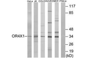 Western blot analysis of extracts from HeLa/Jurkat/HuvEc/MCF-7/COLO cells, using OR4X1 Antibody. (OR4X1 anticorps  (AA 256-305))
