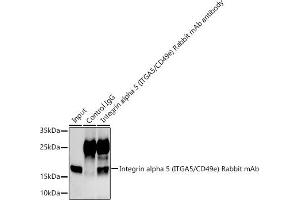 Immunoprecipitation analysis of 300 μg extracts of  cells using 3 μg Integrin alpha 5 (ITG/CD49e) antibody (ABIN7267936). (ITGA5 anticorps)