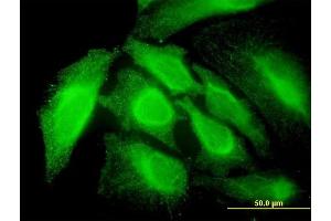 Immunofluorescence of monoclonal antibody to RNF14 on HeLa cell. (RNF14 anticorps  (AA 217-316))