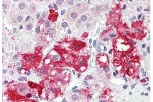 Human Adrenal (formalin-fixed, paraffin-embedded) stained with LASS6 antibody ABIN396945 at 5 ug/ml followed by biotinylated goat anti-rabbit IgG secondary antibody ABIN481713, alkaline phosphatase-streptavidin and chromogen. (CERS6 anticorps  (N-Term))