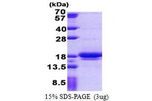 SDS-PAGE (SDS) image for LIM Domain Containing 2 (LIMD2) (AA 1-127) protein (His tag) (ABIN5853121)