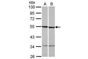 Image no. 1 for anti-Tubulin, beta 1 (TUBB1) (AA 14-260) antibody (ABIN1501568) (TUBB1 anticorps  (AA 14-260))