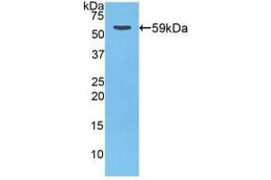 Western blot analysis of recombinant Rat CTSD. (Cathepsin D anticorps  (AA 120-407))