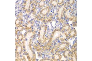 Immunohistochemistry of paraffin-embedded rat kidney using EYA3 antibody. (EYA3 anticorps)