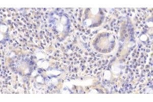 Detection of ROR1 in Human Small intestine Tissue using Polyclonal Antibody to Receptor Tyrosine Kinase Like Orphan Receptor 1 (ROR1)