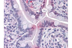 Immunohistochemical analysis of paraffin-embedded human Small Intestine tissues using FABP2 mouse mAb (FABP2 anticorps)