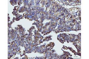 IHC analysis of CD147/Emmprin using anti-CD147/Emmprin antibody (ABIN7599997).