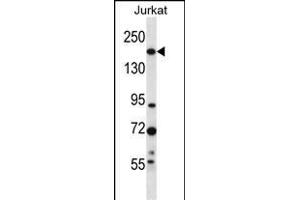 UGCGL1 Antibody (C-term) (ABIN657069 and ABIN2846232) western blot analysis in Jurkat cell line lysates (35 μg/lane). (UGGT1 anticorps  (C-Term))