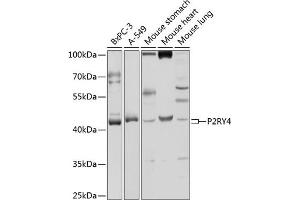 Western blot analysis of extracts of various cell lines, using P2RY4 antibody (ABIN3017281, ABIN3017282, ABIN3017283 and ABIN6220021) at 1:1000 dilution. (P2RY4 anticorps  (AA 286-365))
