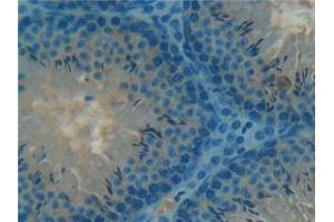 Detection of TXLNa in Mouse Testis Tissue using Polyclonal Antibody to Taxilin Alpha (TXLNa)