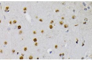 Immunohistochemistry of paraffin-embedded Rat brain using Phospho-CREB1(S133) Polyclonal Antibody at dilution of 1:200 (40x lens). (CREB1 anticorps  (pSer133))