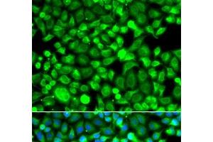 Immunofluorescence analysis of A549 cells using PSMB8 Polyclonal Antibody (PSMB8 anticorps)