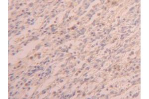 DAB staining on IHC-P; Samples: Human Spleen Tissue