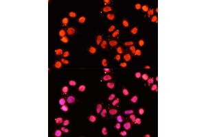 Immunofluorescence analysis of HeLa cells using XRCC1 antibody (ABIN1683300, ABIN5663662, ABIN5663663, ABIN5663664 and ABIN6213850) at dilution of 1:100 (40x lens).