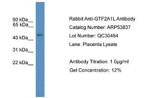 WB Suggested Anti-GTF2A1L  Antibody Titration: 0.