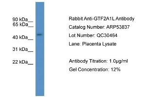WB Suggested Anti-GTF2A1L  Antibody Titration: 0. (GTF2A1L anticorps  (C-Term))
