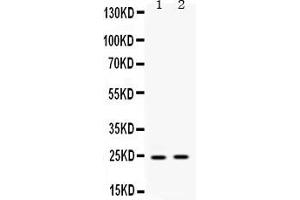 Western blot analysis of HMGB2 expression in rat liver extract ( Lane 1) and human placenta extract ( Lane 2).