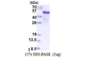 SDS-PAGE (SDS) image for Epoxide Hydrolase 1, Microsomal (Xenobiotic) (EPHX1) (AA 21-455) protein (T7 tag) (ABIN5853545) (EPHX1 Protein (AA 21-455) (T7 tag))