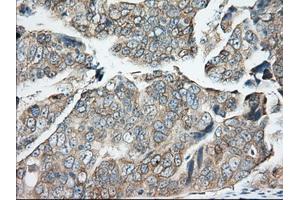 Immunohistochemical staining of paraffin-embedded Human Kidney tissue using anti-BDH2 mouse monoclonal antibody.