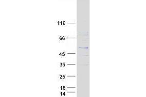 Validation with Western Blot