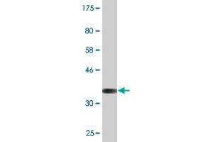 Western Blot detection against Immunogen (37.