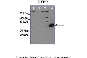 Lanes:   1. (RYBP anticorps  (Middle Region))