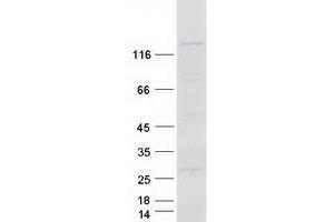 Validation with Western Blot
