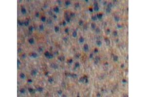Used in DAB staining on fromalin fixed paraffin-embedded Liver tissue (Huntingtin anticorps  (AA 782-920))