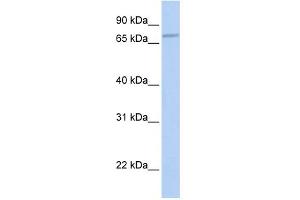 WB Suggested Anti-CABC1 Antibody Titration:  0. (COQ8A anticorps  (N-Term))