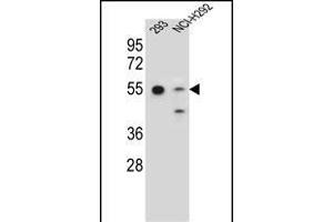 GNAS Antibody (C-term) (ABIN656989 and ABIN2850497) western blot analysis in 293,NCI- cell line lysates (35 μg/lane). (GNAS anticorps  (C-Term))