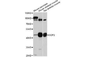 Western blot analysis of extracts of various cell lines, using GDF2 antibody (ABIN5997784) at 1/1000 dilution. (GDF2 anticorps)