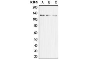 Western blot analysis of MCM2 expression in HeLa (A), Jurkat (B), HeLa (C) whole cell lysates. (MCM2 anticorps  (N-Term))